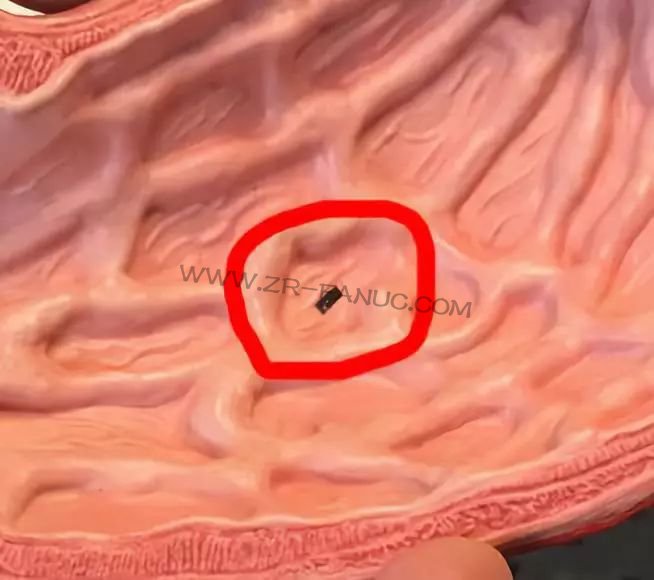 ��С����΢�ͻ����ˣ�������ʲô���ƶ����أ�