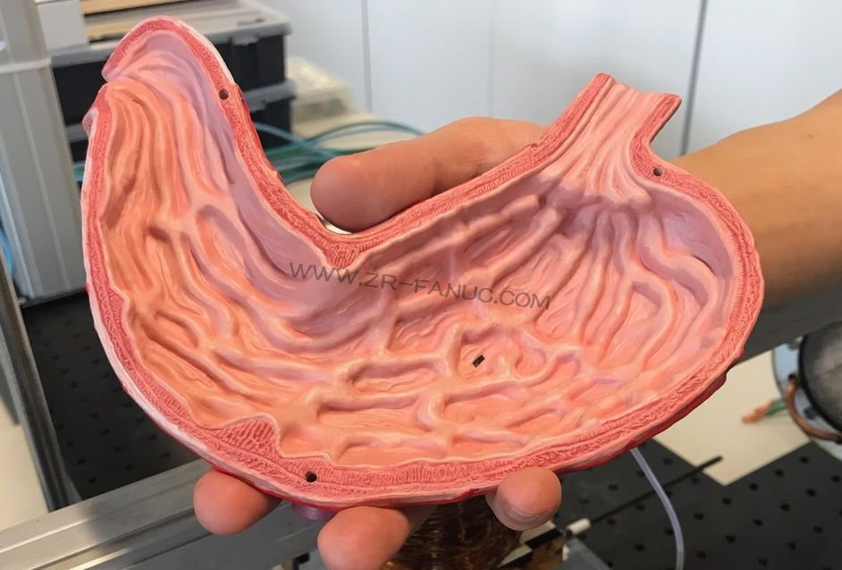 ��С����΢�ͻ����ˣ�������ʲô���ƶ����أ�