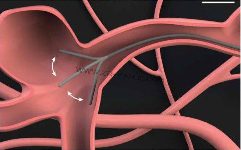 �����з磡����������ܴ������Ե�Ѫ�ܣ��ٵǡ���ѧ-�����ˡ���