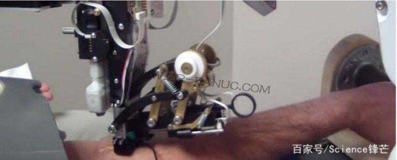 ���������Զ���Ѫ������